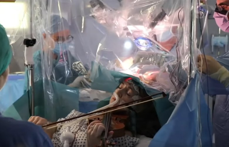 Ασθενής έπαιζε βιολί τη στιγμή της εγχείρησης στον εγκέφαλό της